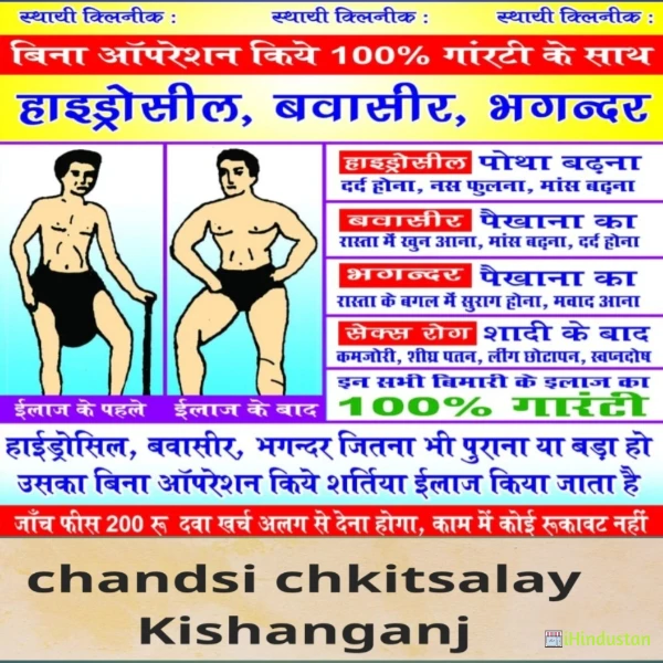 Chandsi chikitsalaya kishanganj 900