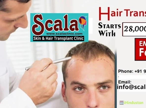 Scala Skin  Hair Transplant Clinic in Chanda NagarHyderabad  Best Beauty  Clinics For Hair Removal in Hyderabad  Justdial